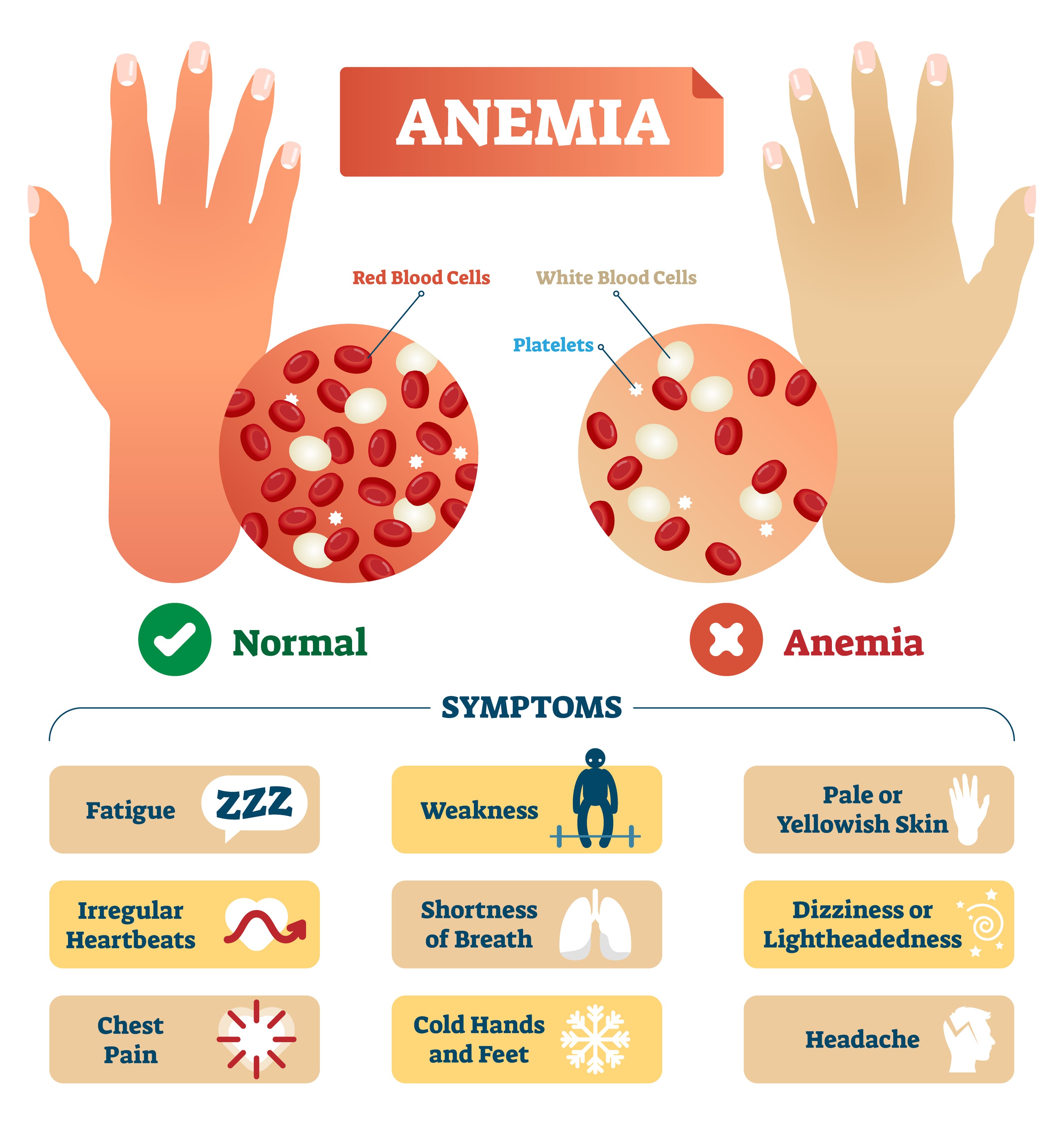 Symptoms of anemia Buyers Reviews