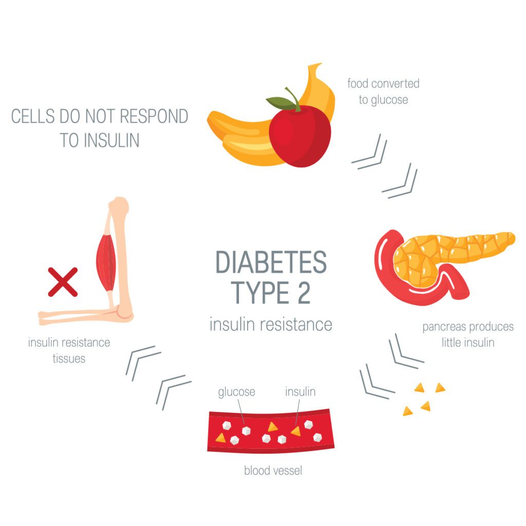 type 2 diabetes chart