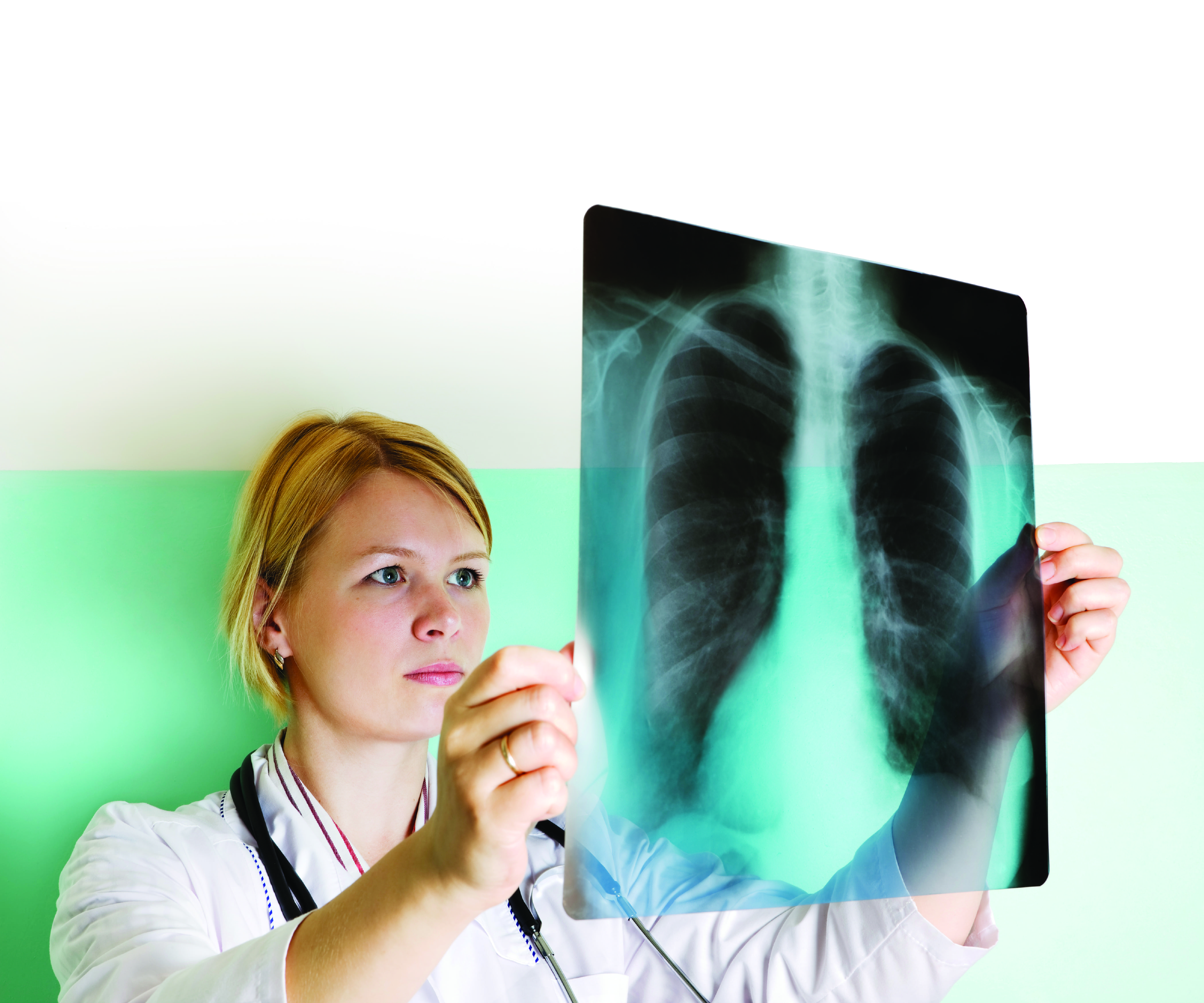 Легкие человека с туберкулезом. Рентген. Рентгенография органов дыхания.