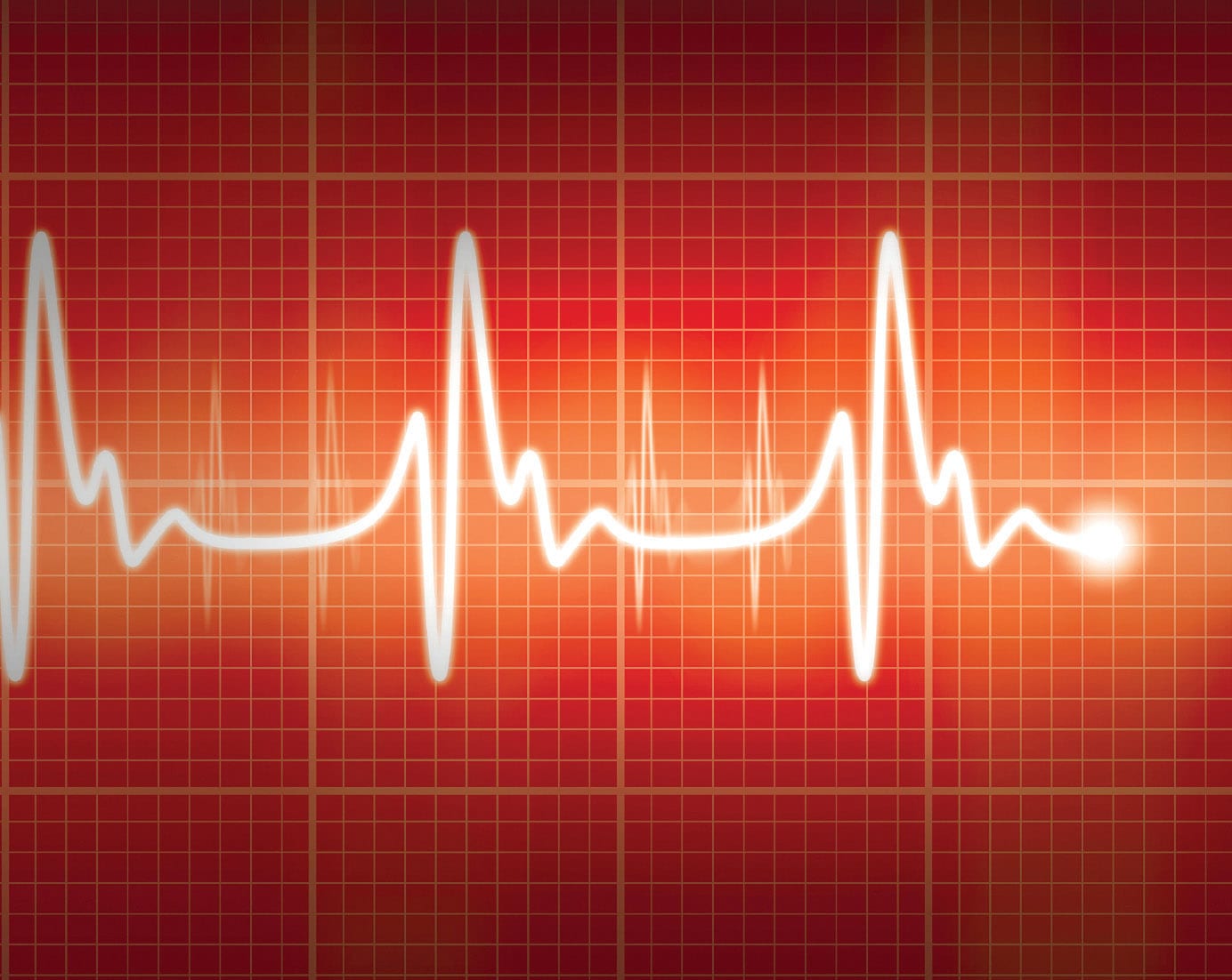 Which Type Of Arrhythmia Is Dangerous