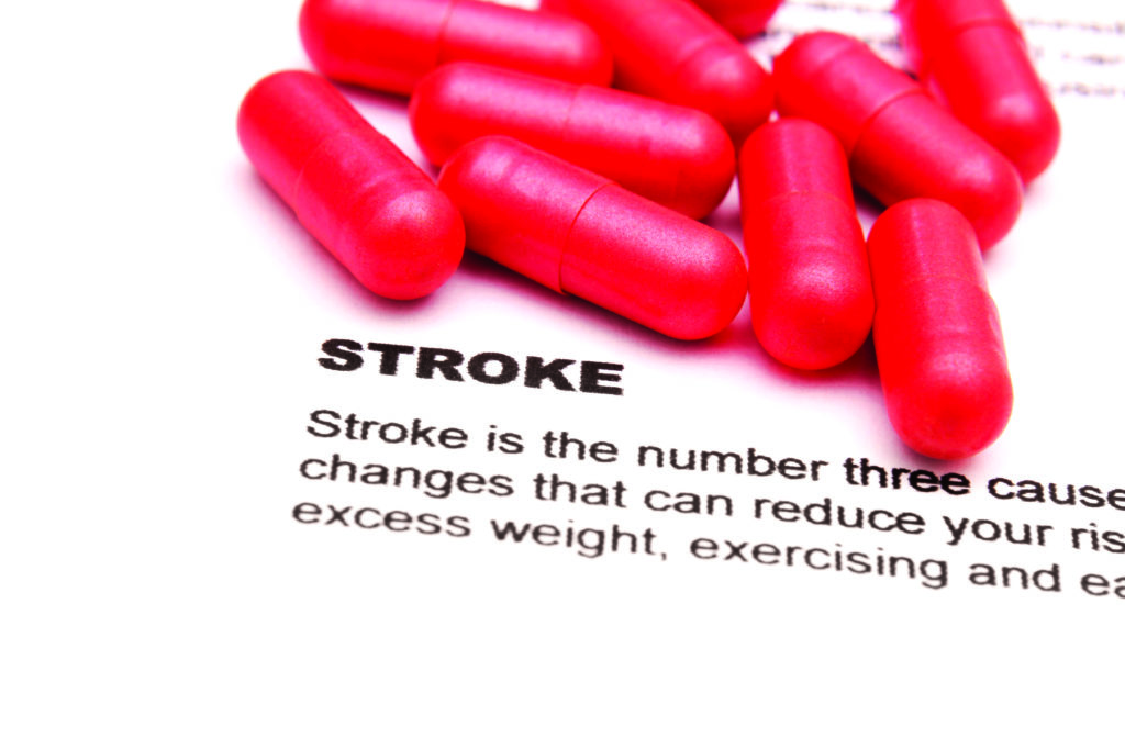 Understanding Stroke Healthscopehealthscope 9751