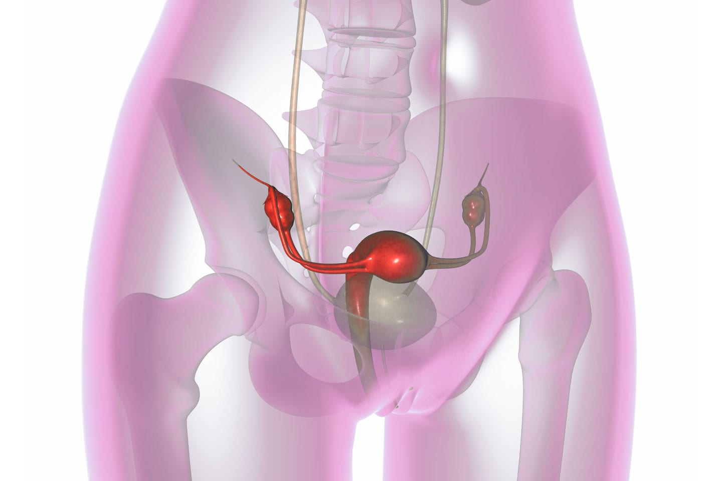 Medical graphic of Ovarian Cysts