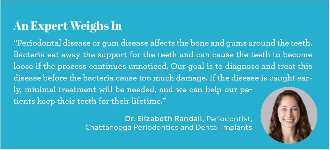 expert opinion chattanooga doctor elizabeth randall chattanooga periodontics and dental implants