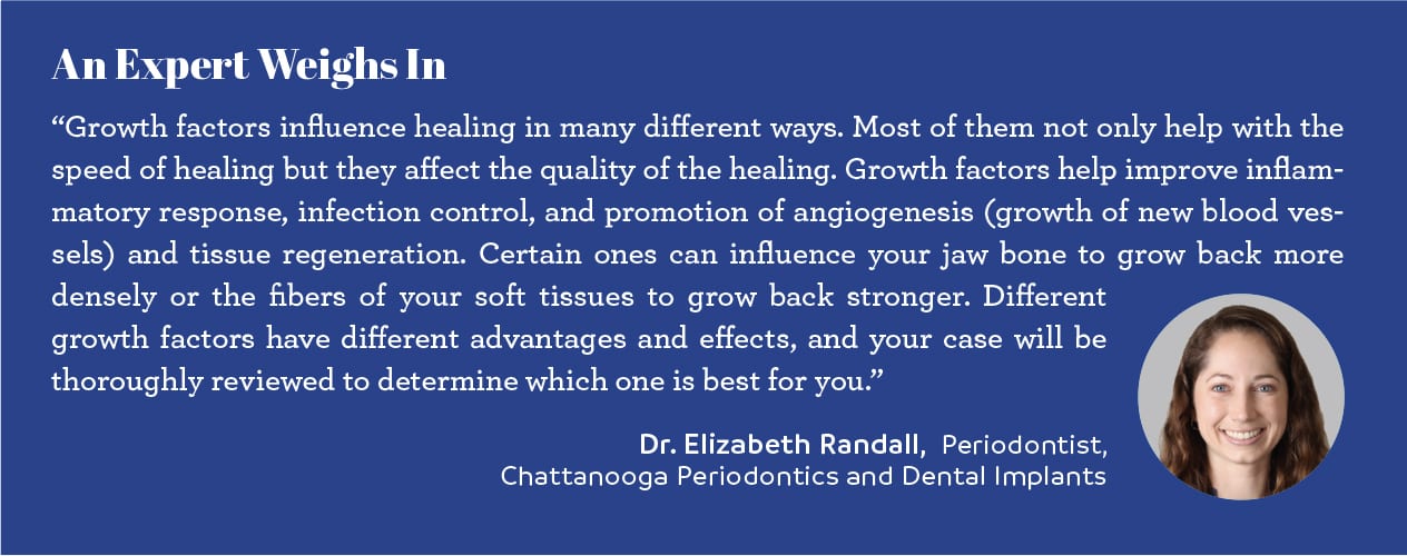 Expert opinion chattanooga doctor elizabeth randall chattanooga periodontics and dental implants chattanooga