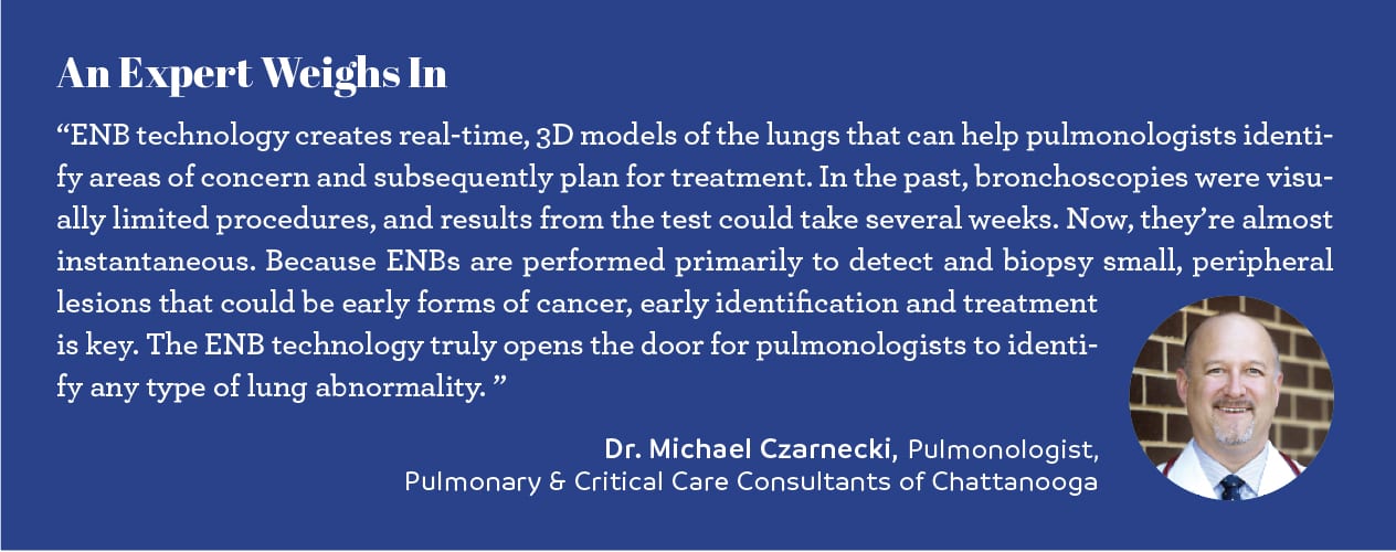 expert opinion chattanooga doctor michael czarnecki pulmonologist pulmonary and critical care consultants of chattanooga 