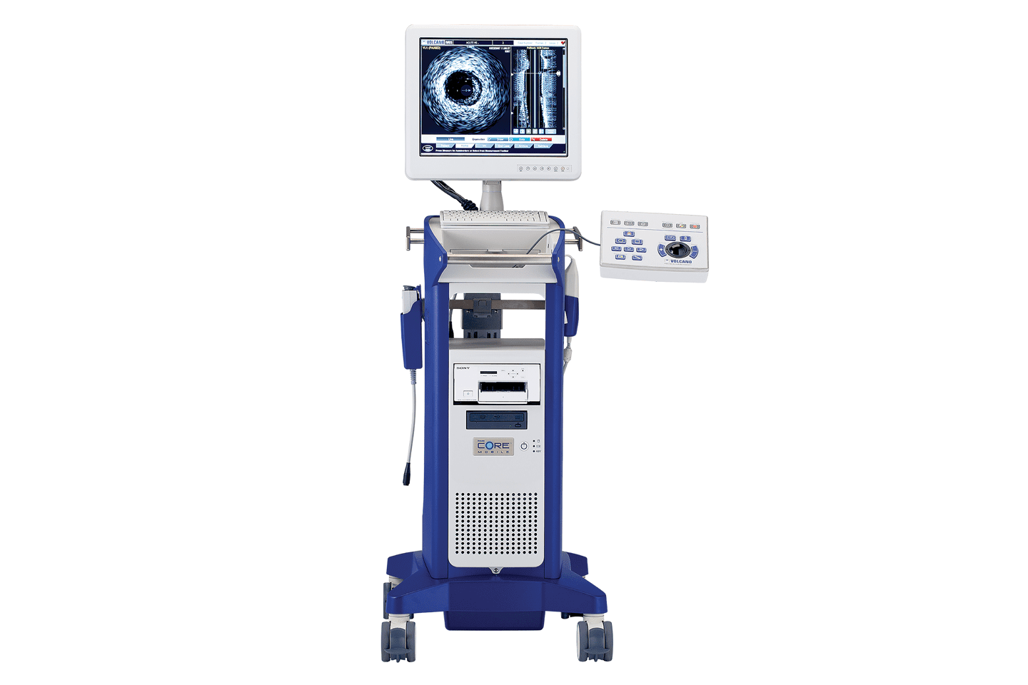 Volcano Core precision guided therapy system for performing intravascular ultrasound (IVUS) in Chattanooga