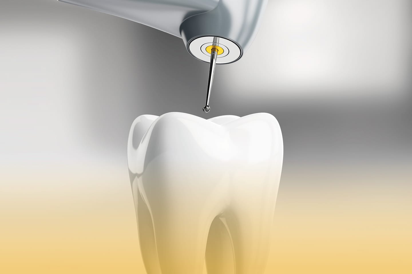 illustration of a tooth getting a root canal in chattanooga