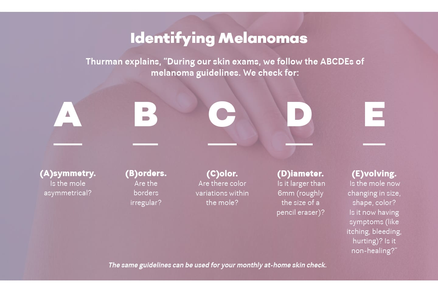 How to identify melanomas in chattanooga