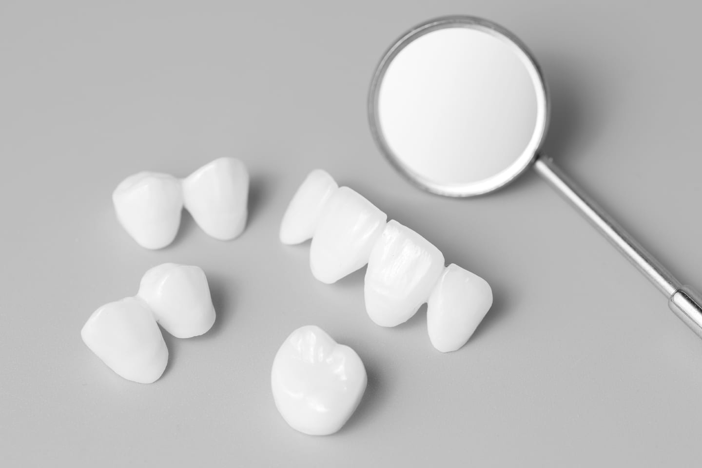 veneers for teeth dental health in chattanooga