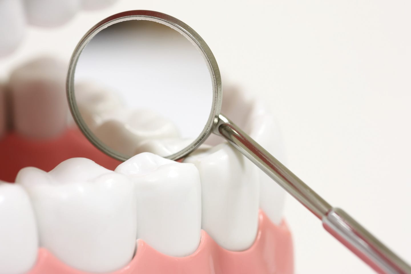 Aging Well Replacement Options for Missing Teeth