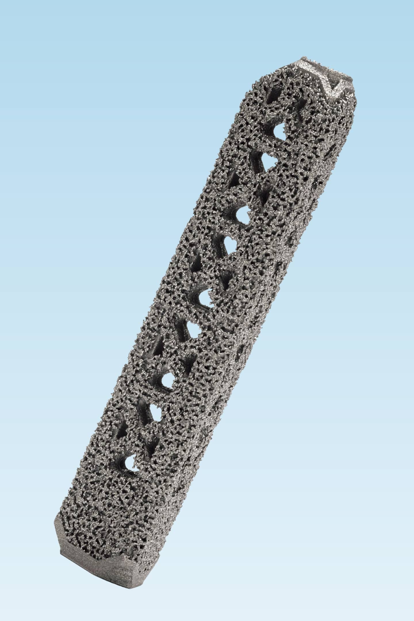 Advancements in Sacroiliac Joint Dysfunction Treatment iFuse implant chattanooga