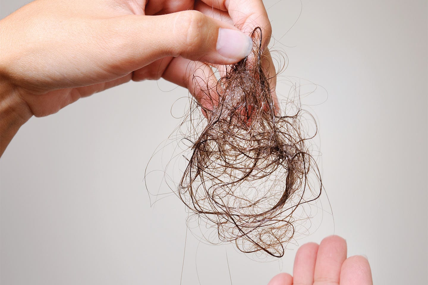 woman holding a clump of her hair due to hair loss