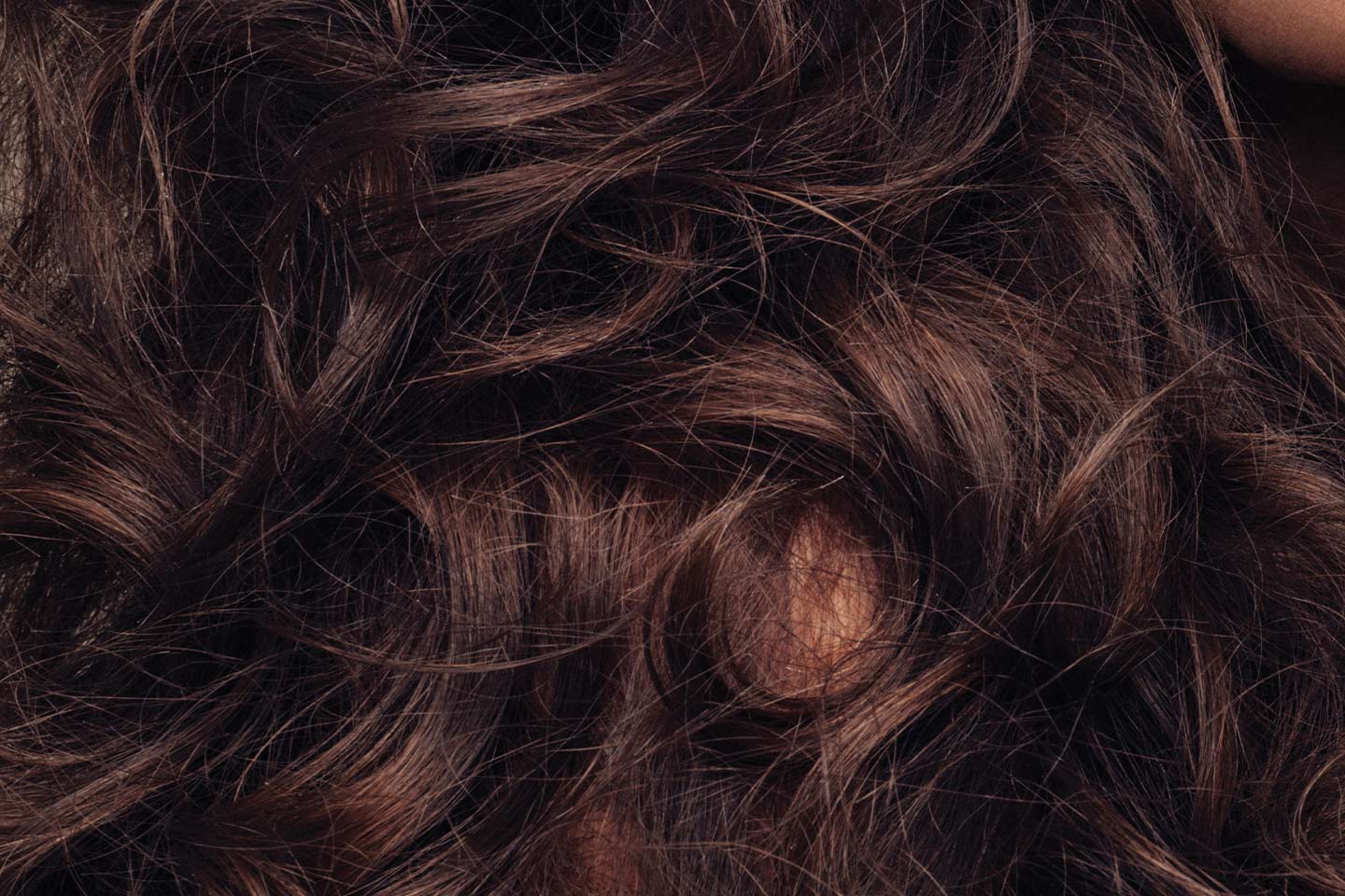 8 Common Hair Problems & How to Solve Them - HealthScopeHealthScope