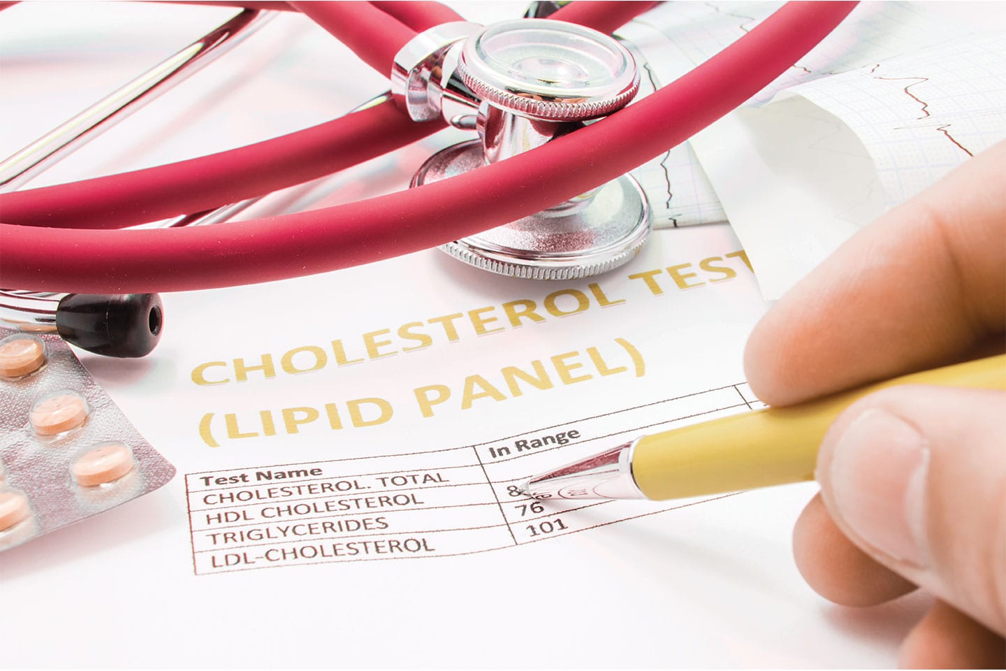 doctor writing results in a Cholesterol test (lipid panel)