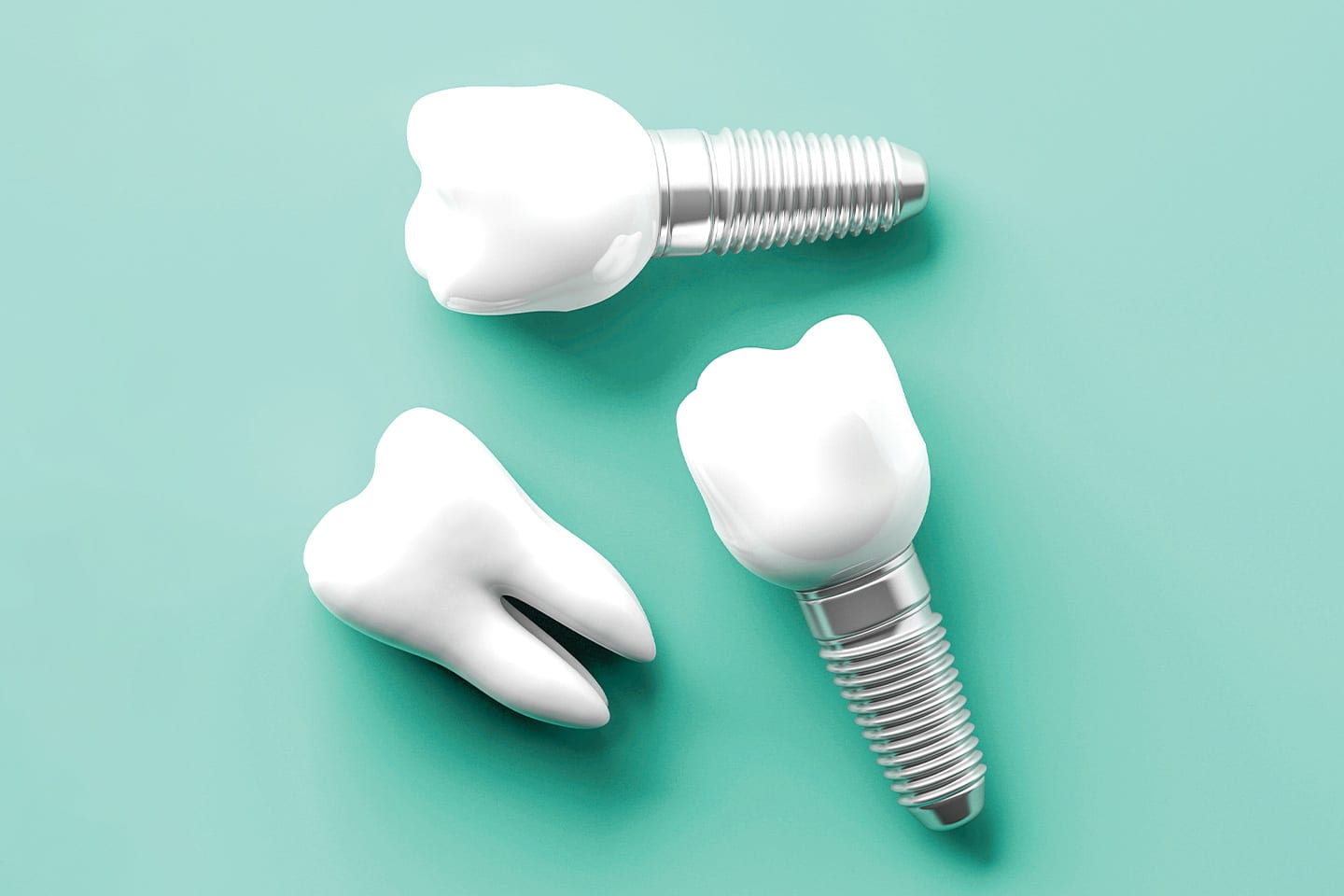 dental implants and a tooth