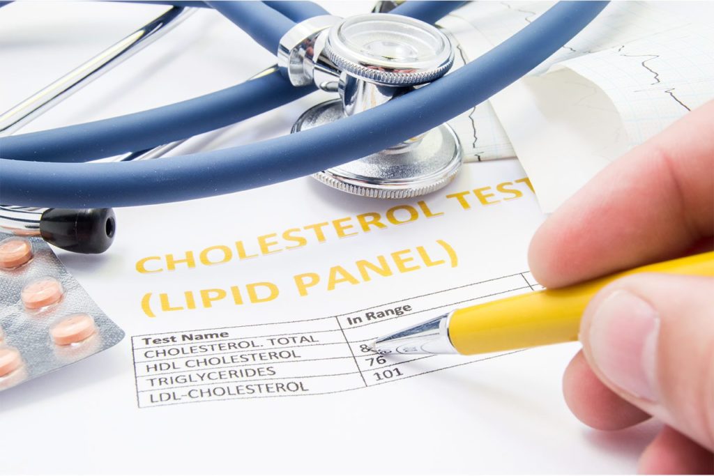 Top Cholesterol Lowering Foods