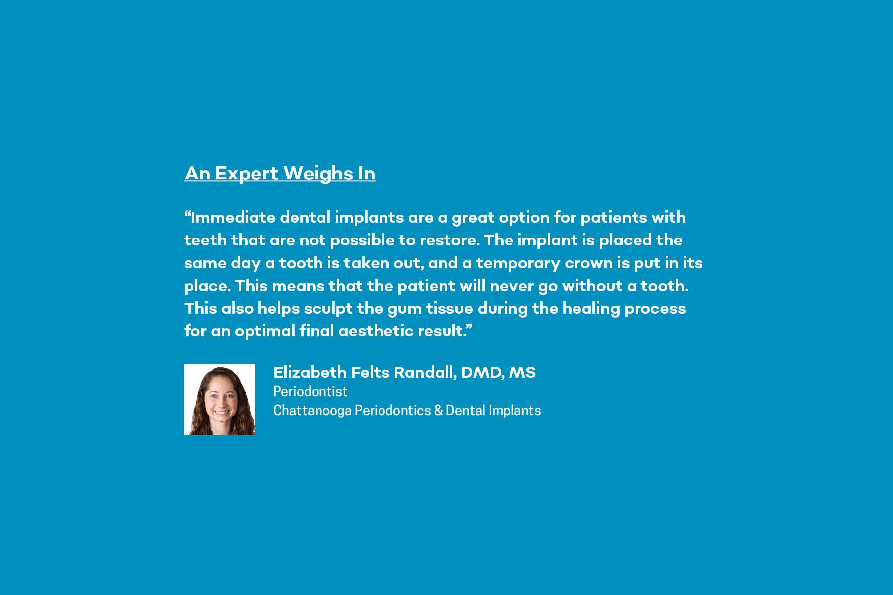 Expert opinion on immediate dental implants from Dr. Elizabeth Felts Randall at Chattanooga Periodontics and Dental Implants