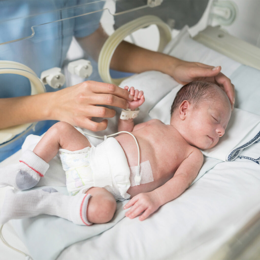 preterm infant receiving treatment