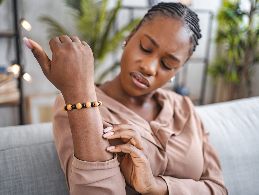 woman with eczema inspecting it