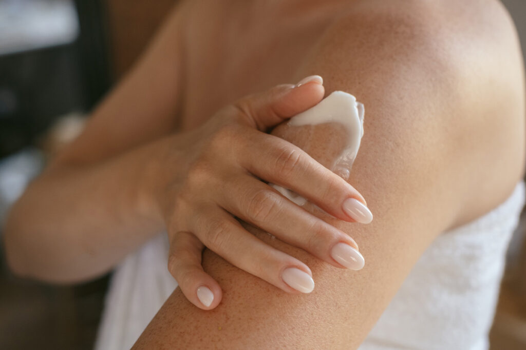 woman rubbing creme on eczema