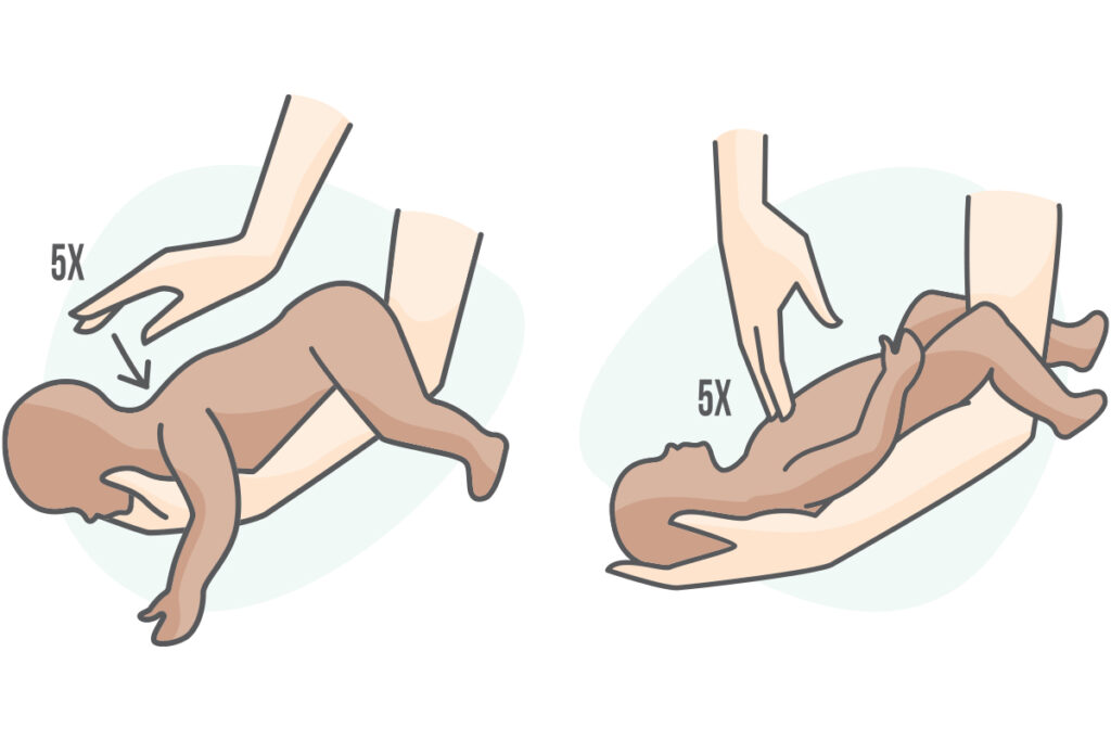 Illustration demonstrating baby CPR techniques, showing hand placements for back and chest compressions on an infant.