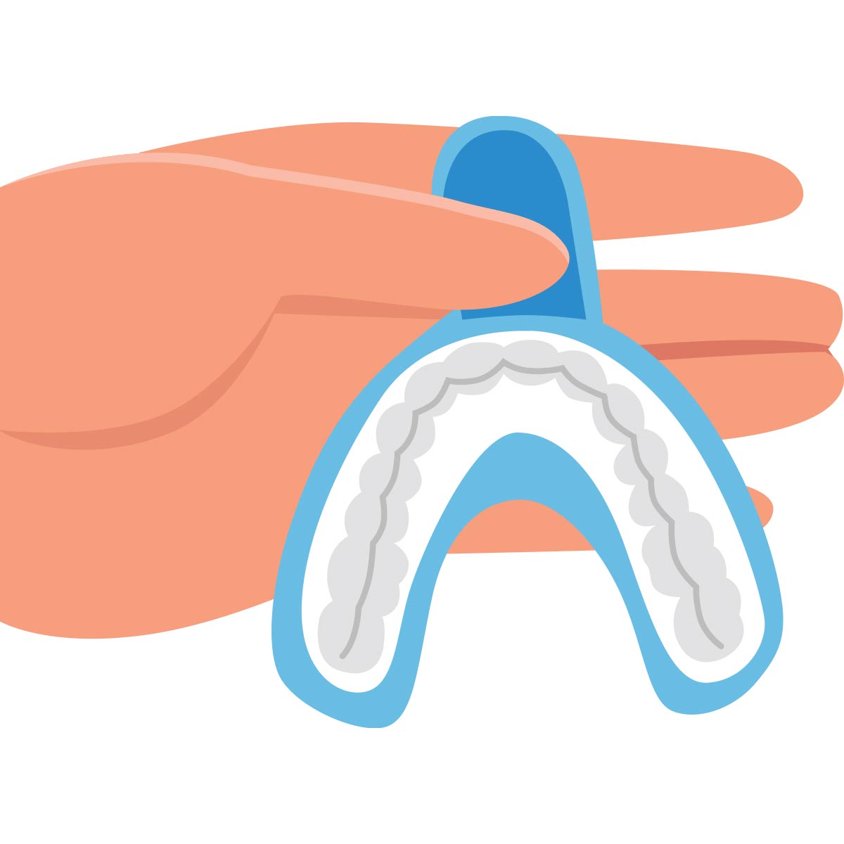 A hand holding a blue mouthguard with a white interior, designed for dental protection or sports.