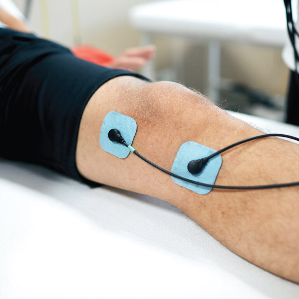 A close-up of a person's knee with electrode pads attached, connected to wires for muscle stimulation therapy.