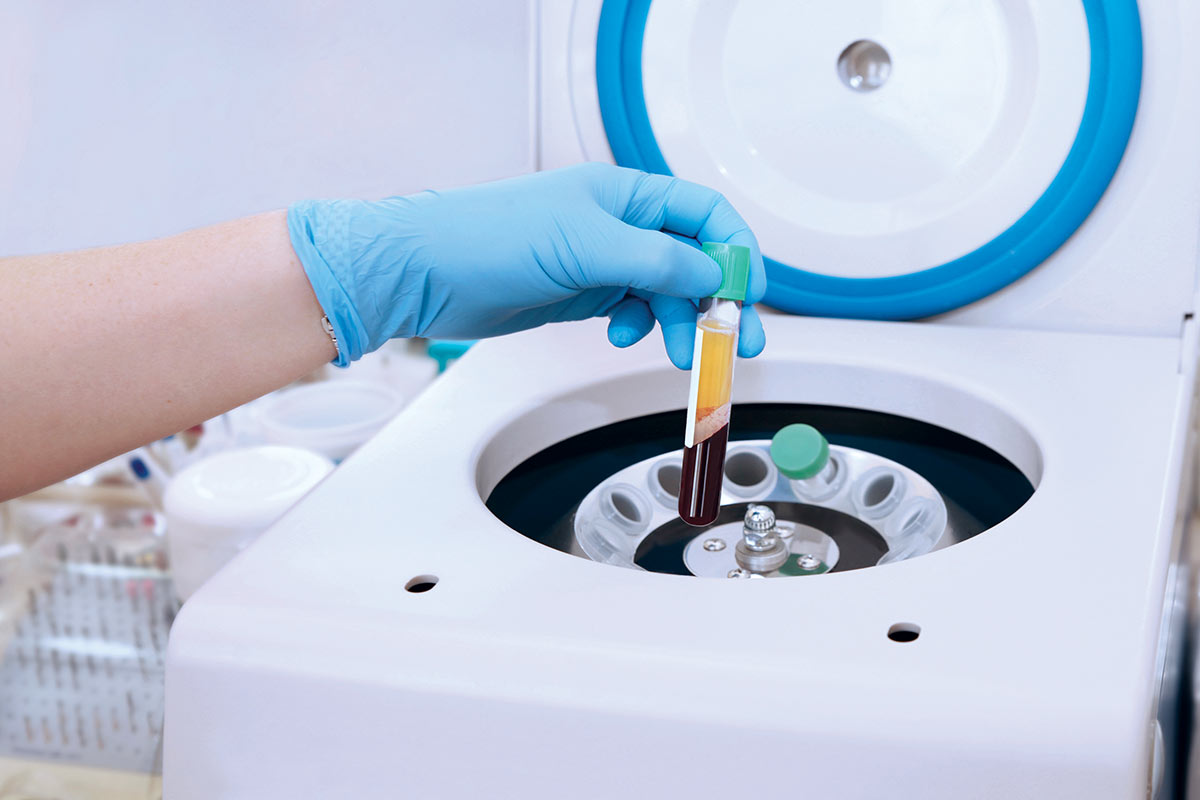 A gloved hand places a blood sample tube into a laboratory centrifuge for processing.