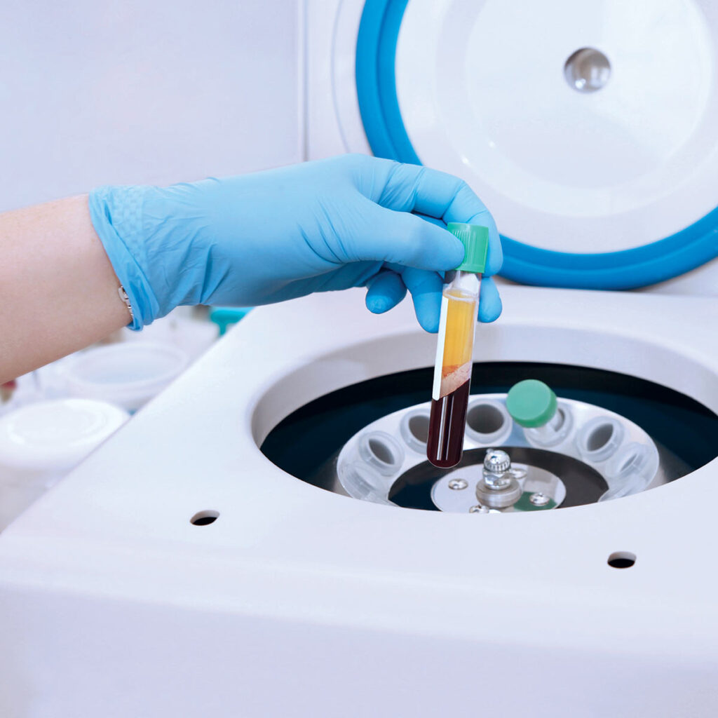 A gloved hand places a blood sample tube into a laboratory centrifuge for processing.