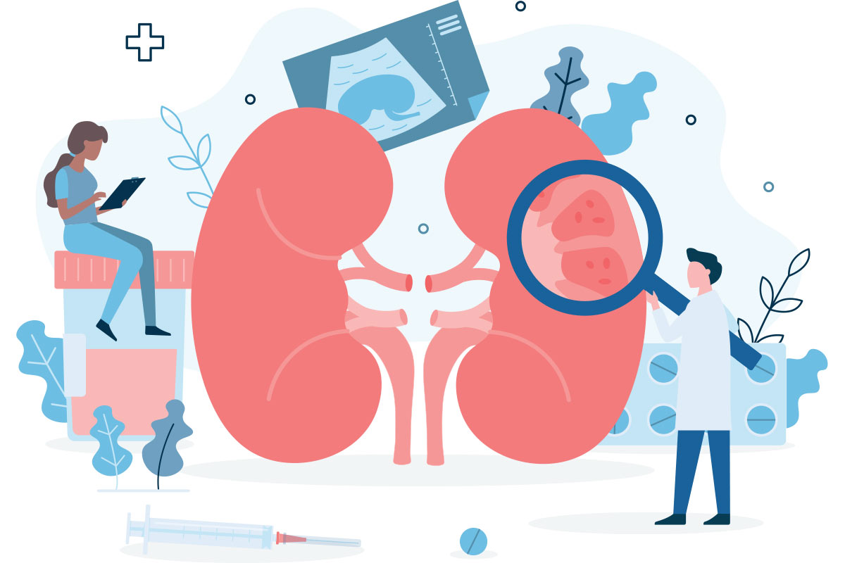 Illustration of Doctors looking at Kidneys