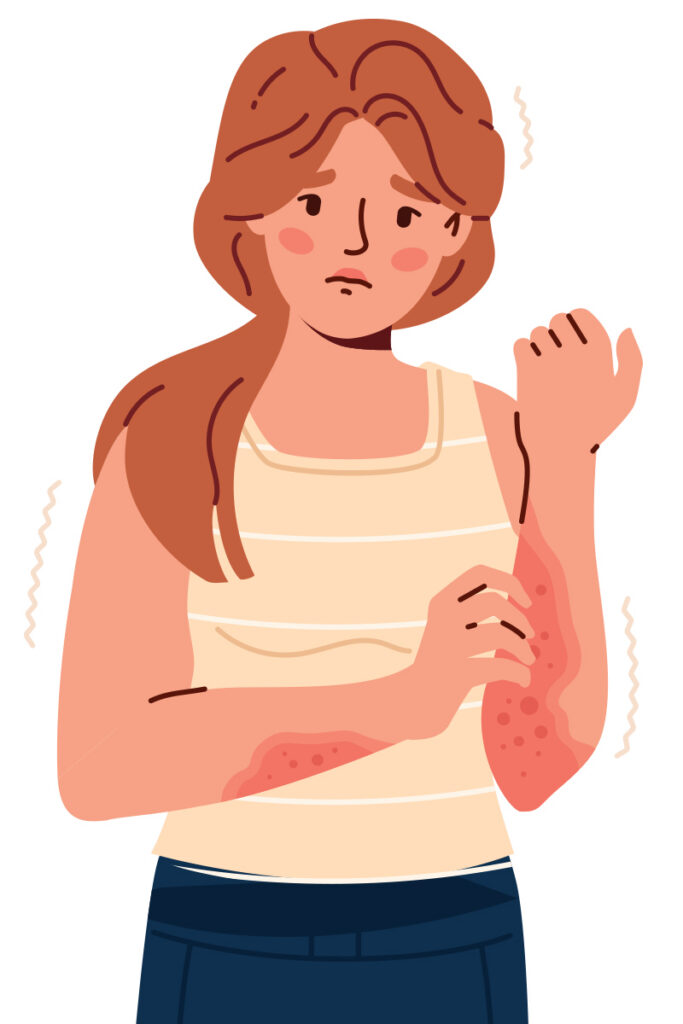 illustration of woman with rash on arm