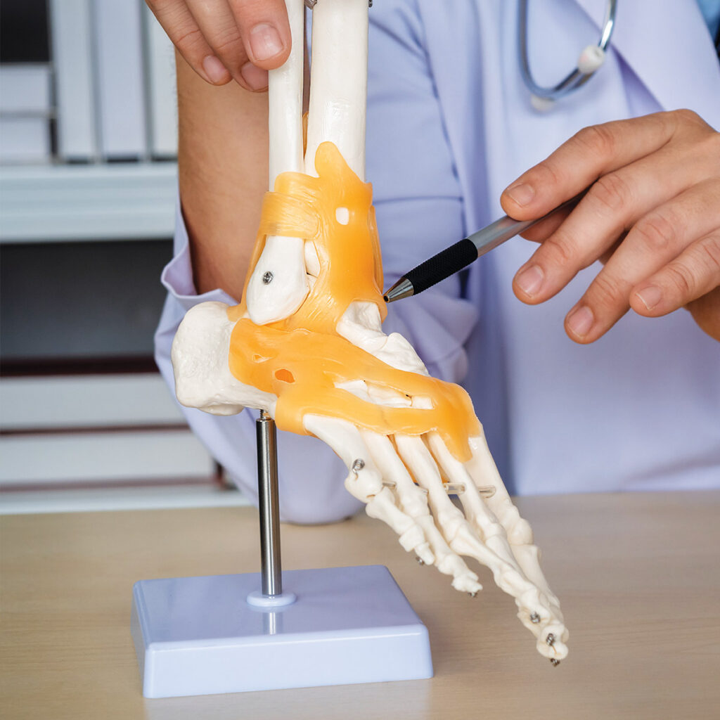Total ankle replacement display