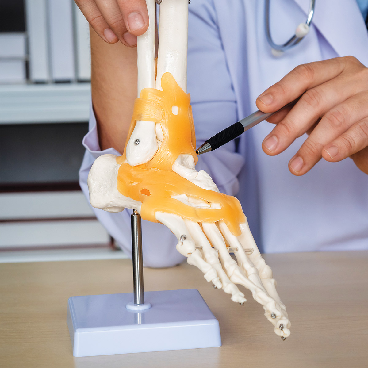 Total ankle replacement display