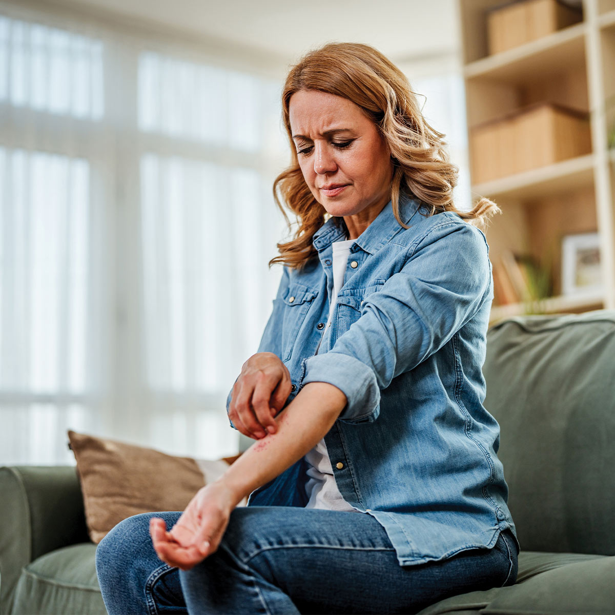woman with atopic dermatitis