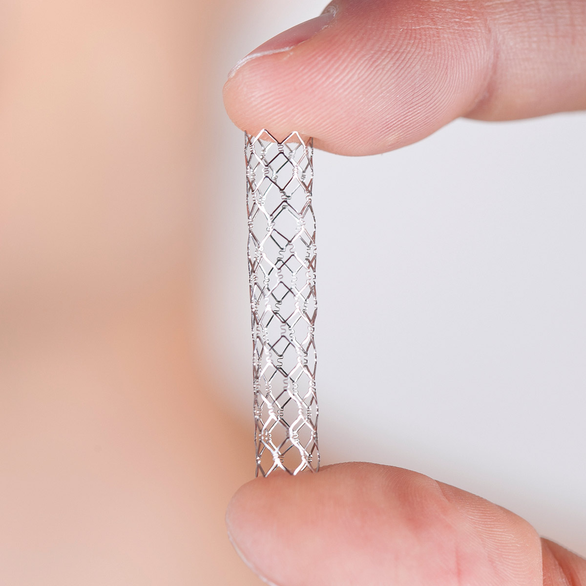 Transcarotid Revascularization (TCAR)