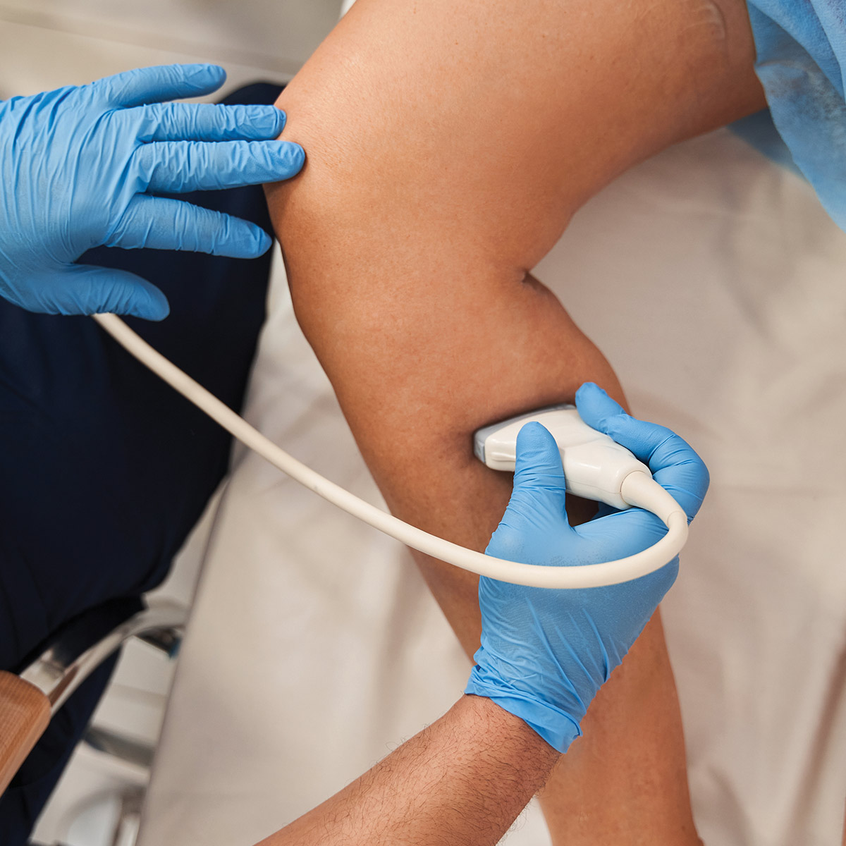 ultrasound on leg